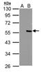 Protein Phosphatase 4 Regulatory Subunit 2 antibody, NBP2-19914, Novus Biologicals, Western Blot image 