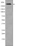 ATM Serine/Threonine Kinase antibody, PA5-64773, Invitrogen Antibodies, Western Blot image 