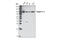 Integrin Subunit Beta 5 antibody, 3629S, Cell Signaling Technology, Western Blot image 