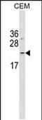 Fibronectin Type III Domain Containing 4 antibody, PA5-48949, Invitrogen Antibodies, Western Blot image 