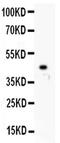 Hepatocyte nuclear factor 1-alpha antibody, PA5-79379, Invitrogen Antibodies, Western Blot image 