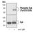 Spleen Associated Tyrosine Kinase antibody, MA5-14918, Invitrogen Antibodies, Western Blot image 