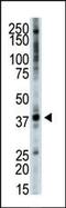 Tribbles Pseudokinase 3 antibody, PA5-15480, Invitrogen Antibodies, Western Blot image 