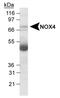 NADPH Oxidase 4 antibody, NB110-58849B, Novus Biologicals, Western Blot image 