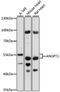 Angiopoietin 1 antibody, 15-838, ProSci, Western Blot image 