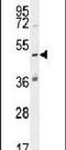 Katanin Catalytic Subunit A1 Like 1 antibody, PA5-23735, Invitrogen Antibodies, Western Blot image 