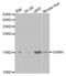 Growth Hormone Releasing Hormone antibody, abx004085, Abbexa, Western Blot image 