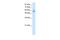 Transmembrane Protein 175 antibody, PA5-68634, Invitrogen Antibodies, Western Blot image 