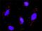 Peroxisome Proliferator Activated Receptor Delta antibody, H00005467-M01, Novus Biologicals, Proximity Ligation Assay image 