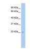 Tumor Suppressor Candidate 1 antibody, NBP1-70738, Novus Biologicals, Western Blot image 