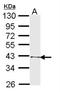 T-cell acute lymphocytic leukemia protein 1 antibody, NBP1-33757, Novus Biologicals, Western Blot image 