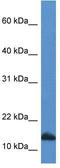 Cytidine deaminase antibody, TA343116, Origene, Western Blot image 