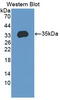 Ectonucleotide Pyrophosphatase/Phosphodiesterase 2 antibody, abx131740, Abbexa, Western Blot image 