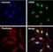 Chromobox 5 antibody, MA1-218, Invitrogen Antibodies, Immunofluorescence image 