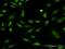 Protein Kinase C Delta antibody, MA5-19701, Invitrogen Antibodies, Immunofluorescence image 
