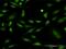 Protein Kinase C Delta antibody, MA5-19701, Invitrogen Antibodies, Immunofluorescence image 