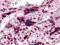 Colony Stimulating Factor 1 antibody, NBP1-47472, Novus Biologicals, Immunohistochemistry paraffin image 