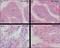 B-Raf Proto-Oncogene, Serine/Threonine Kinase antibody, NBP1-47668, Novus Biologicals, Immunohistochemistry frozen image 