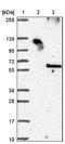 Calcitonin Receptor antibody, NBP1-88041, Novus Biologicals, Western Blot image 