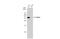 N-Acylsphingosine Amidohydrolase 1 antibody, GTX114267, GeneTex, Western Blot image 