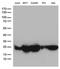 O-6-Methylguanine-DNA Methyltransferase antibody, LS-C794812, Lifespan Biosciences, Western Blot image 