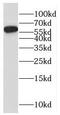 Recombination Activating 2 antibody, FNab07089, FineTest, Western Blot image 