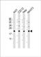 RAB7A, Member RAS Oncogene Family antibody, PA5-72549, Invitrogen Antibodies, Western Blot image 