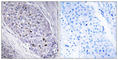Myocyte-specific enhancer factor 2C antibody, abx013582, Abbexa, Western Blot image 