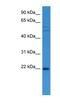 Growth Arrest And DNA Damage Inducible Alpha antibody, NBP1-79791, Novus Biologicals, Western Blot image 