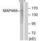 MINK1 antibody, A06134, Boster Biological Technology, Western Blot image 