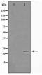 TNF Alpha Induced Protein 8 antibody, TA347583, Origene, Western Blot image 