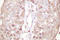 SUMO Specific Peptidase 1 antibody, LS-C176345, Lifespan Biosciences, Immunohistochemistry paraffin image 