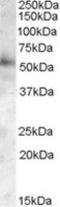 Golgi Associated PDZ And Coiled-Coil Motif Containing antibody, MBS421395, MyBioSource, Western Blot image 