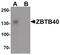 Zinc Finger And BTB Domain Containing 40 antibody, PA5-34400, Invitrogen Antibodies, Western Blot image 