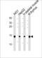 Ubiquitin Conjugating Enzyme E2 D1 antibody, 61-076, ProSci, Western Blot image 