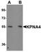 Karyopherin Subunit Alpha 4 antibody, orb75500, Biorbyt, Western Blot image 