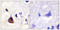 Phosphoinositide-3-Kinase Regulatory Subunit 1 antibody, LS-C199437, Lifespan Biosciences, Immunohistochemistry paraffin image 