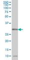 N-Methylpurine DNA Glycosylase antibody, H00004350-M10, Novus Biologicals, Western Blot image 