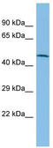 GCPII antibody, TA336088, Origene, Western Blot image 