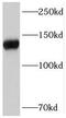 Stromal Antigen 2 antibody, FNab08282, FineTest, Western Blot image 