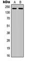 Colony Stimulating Factor 1 Receptor antibody, orb256473, Biorbyt, Western Blot image 