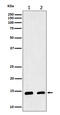 Cellular Retinoic Acid Binding Protein 2 antibody, M03297-1, Boster Biological Technology, Western Blot image 