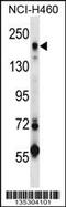 Mannose Receptor C Type 2 antibody, 58-238, ProSci, Western Blot image 