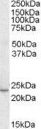 Kruppel Like Factor 16 antibody, GTX89911, GeneTex, Western Blot image 