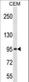 G Protein-Coupled Receptor Kinase 3 antibody, LS-C164294, Lifespan Biosciences, Western Blot image 