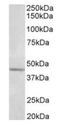 Synaptotagmin 5 antibody, orb12322, Biorbyt, Western Blot image 