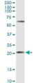 Adenine Phosphoribosyltransferase antibody, H00000353-D01P, Novus Biologicals, Western Blot image 