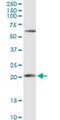 Adenine Phosphoribosyltransferase antibody, H00000353-D01P, Novus Biologicals, Western Blot image 