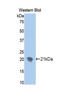 Ectonucleotide Pyrophosphatase/Phosphodiesterase 1 antibody, LS-C304172, Lifespan Biosciences, Western Blot image 