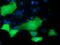 Protein Kinase D2 antibody, LS-C115611, Lifespan Biosciences, Immunofluorescence image 